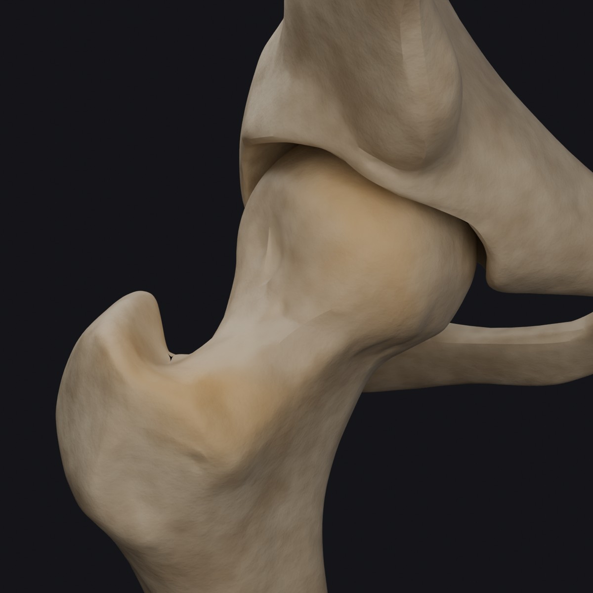 3D render of a hip joint with cam morphology: extra bone at the head and neck junction of the femur, built from BodyParts3D anatomical models