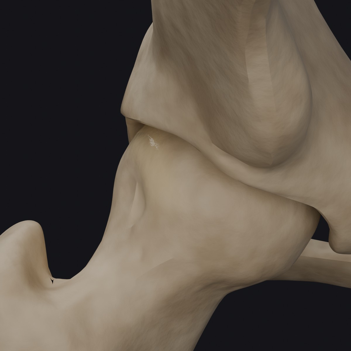 3D render of a worn hip joint: cartilage gone at the dome, femoral head seated bone on bone in the socket, built from BodyParts3D anatomical models